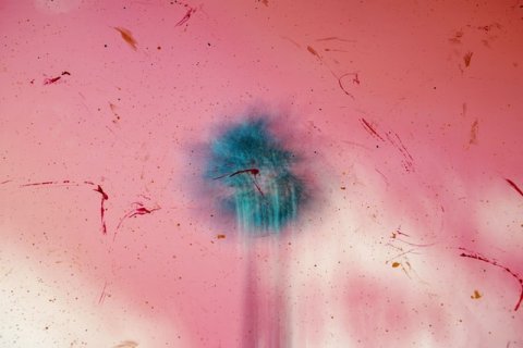 Meyer über Weimer: Ich vermisse die Transparenz in der ganzen Angelegenheit und das ohne Not